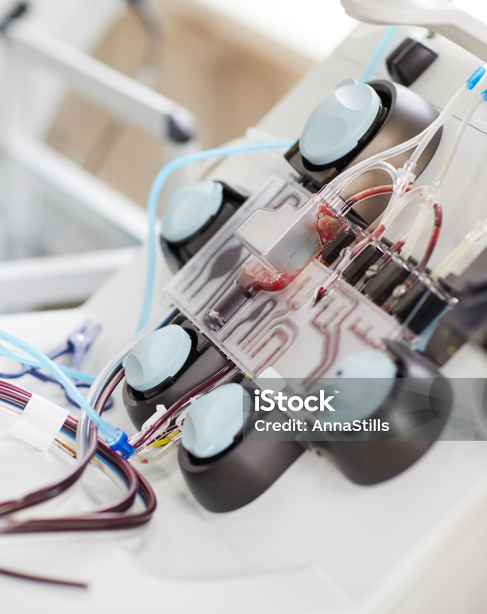 Plasma Testing