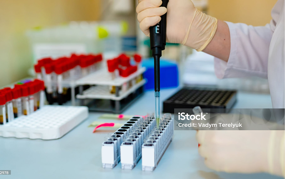 Plasma Testing